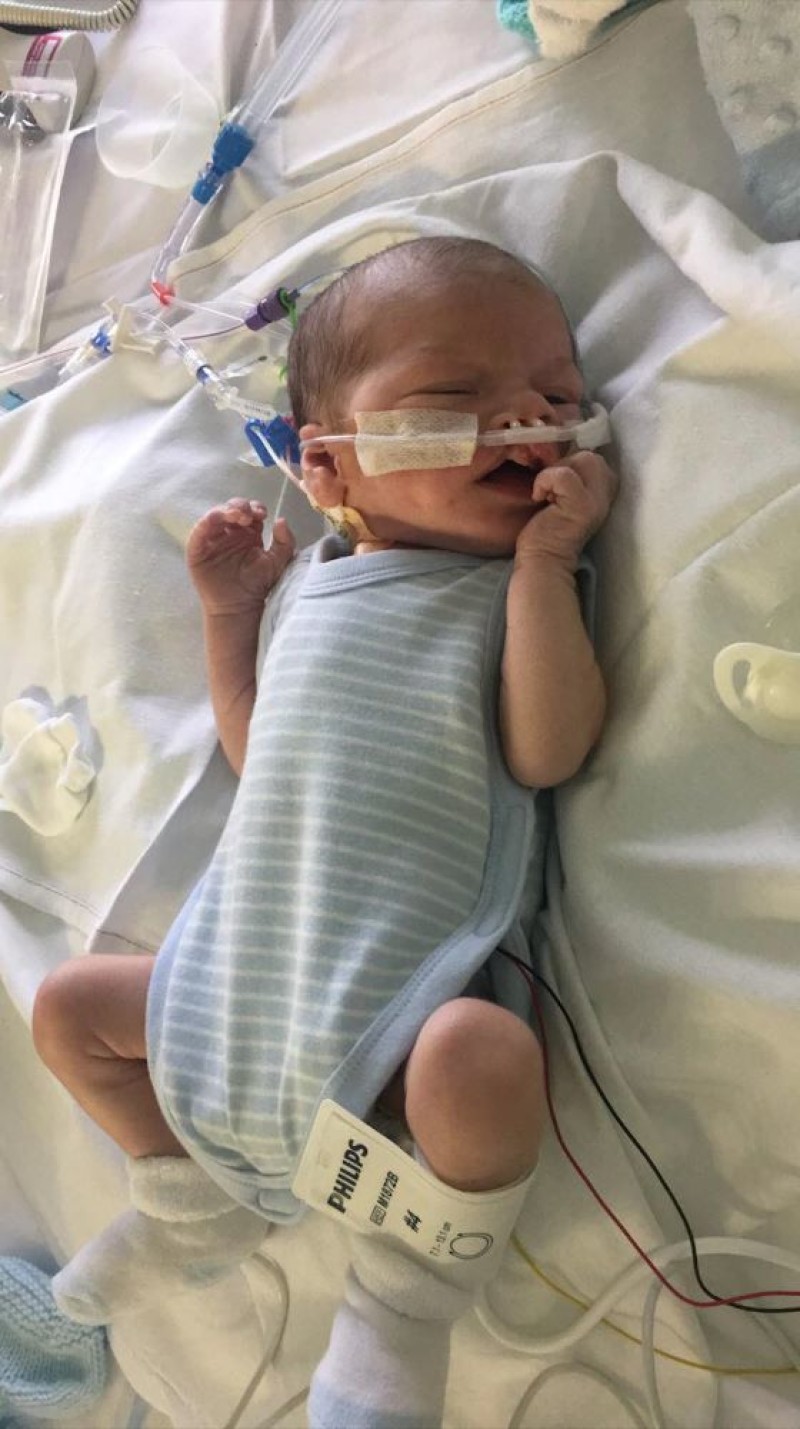 Other image for ‘Huge relief’ as baby Hugo battles on after heart op